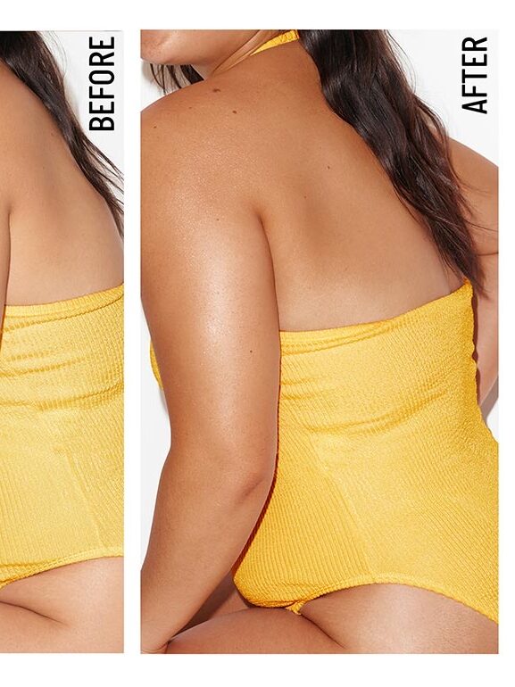 Side-by-side comparison of a person's back and shoulder before and after using a product, showing smoother skin in the "after" image. Person is wearing a yellow strapless swimsuit. Text: "Anna Shade: Dark.