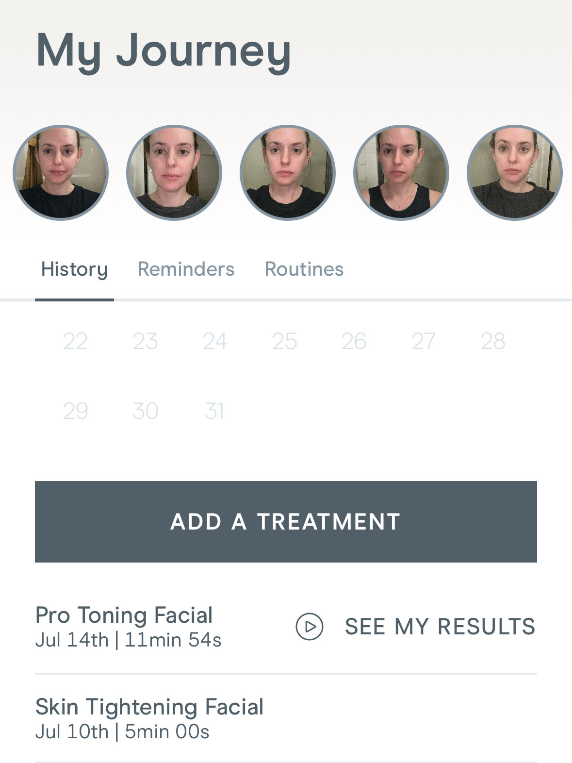 Screenshot of an app showing a user's skincare journey with sections for history, reminders, and routines. Photos of facial progress are at the top, followed by treatment dates and durations below.