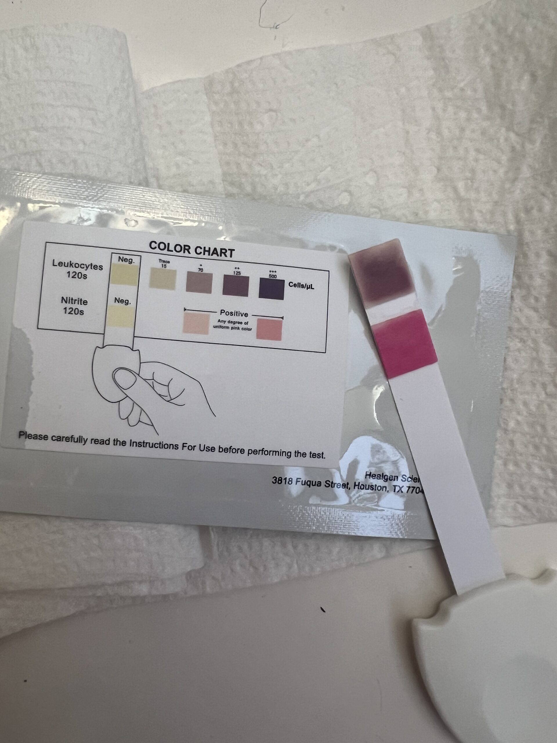 A medical test strip with color guide showing results for leukocytes and nitrites on a chart next to a testing apparatus on a white surface.