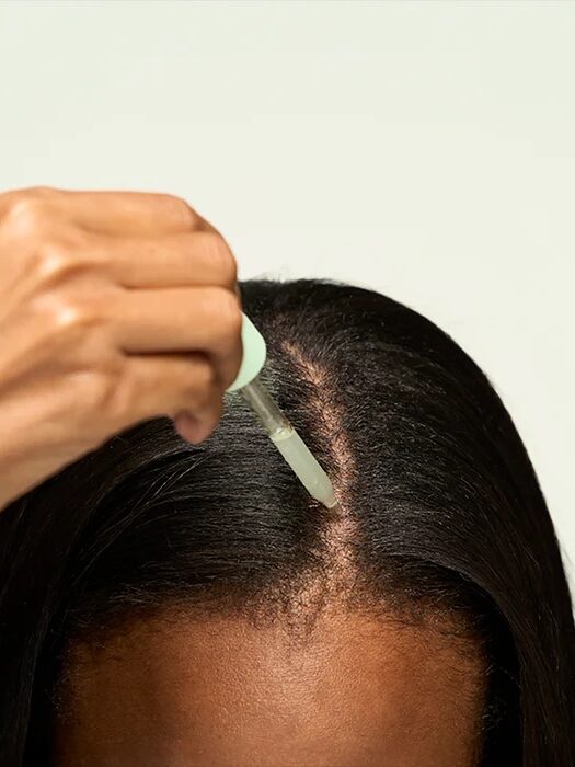 A hand applies a dropper of serum to the scalp of a woman with dark hair.