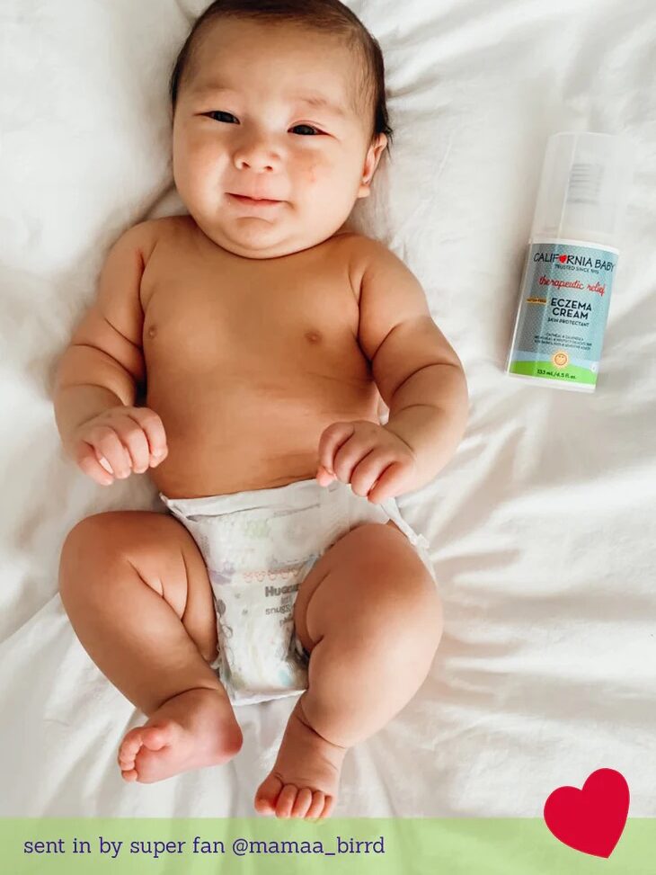 A baby wearing a diaper lies on a white surface next to a bottle of eczema cream.